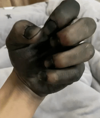 小伙用钢丝球刷手,背后故事让人泪目!